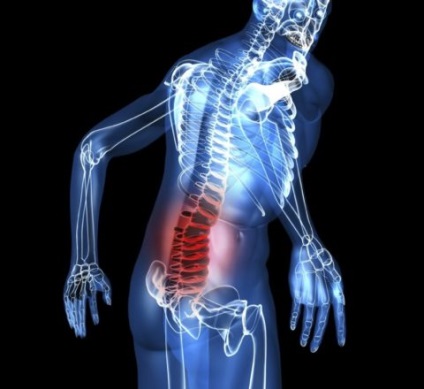 Fractura compresivă a simptomelor coloanei vertebrale, traumatologie