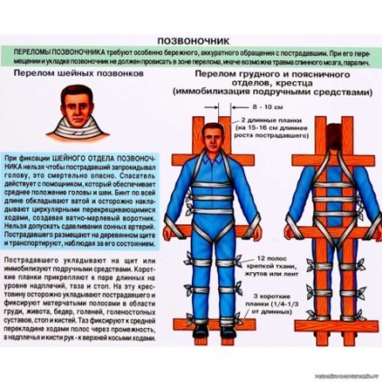 Fractura compresivă a simptomelor coloanei vertebrale, traumatologie