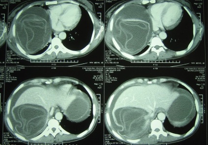 Ct ficat, prețurile de la 3200 de ruble, 10 adrese pe ktdiagnostik