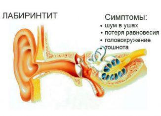 Labyrinthitis tünetek kezelésére felnőttek és gyerekek