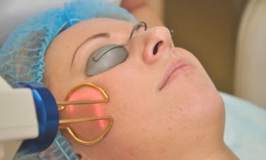 Cosmetică laser în centrul medical, preț, înregistrare la recepția din St. Petersburg în clinica Scandinavia