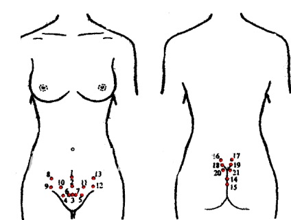 Tratamentul cu fibromul leucoprotetic al uterului