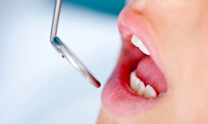 Tratamentul laser al dinților și al minusurilor