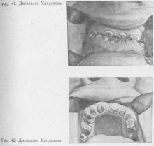 Tulburări ereditare ale dezvoltării dentare, stomatologie terapeutică