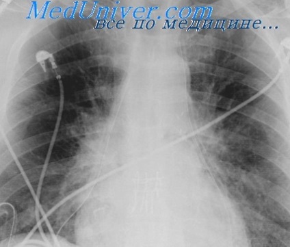 Examinarea cu patologie bronhopulmonară