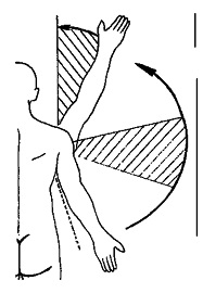 Pleuropatia simptom periarartritei, diagnostic și tratament