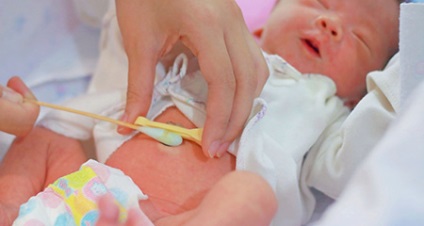 Copilul nou-născutului - cum să se ocupe, de ce se crustează