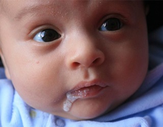 Tünetei és kezelése reflux csecsemőknél, ru-babyhealth