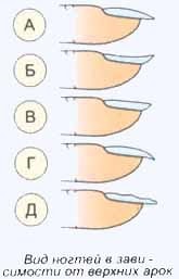 Tipuri de unghii, în funcție de tipul de arc