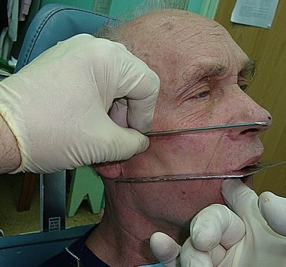 Îngrijirea pacienților cu chirurgie maxilo-facială