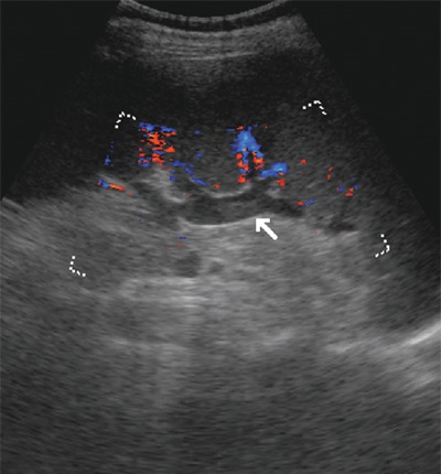 Az a lehetőség, ultrahang színes Doppler diagnosztikájában