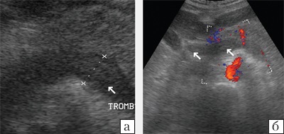 Az a lehetőség, ultrahang színes Doppler diagnosztikájában