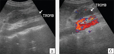 Az a lehetőség, ultrahang színes Doppler diagnosztikájában