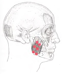 Mușchii mușchilor (dureri la maxilar și mușchi de mestecat)