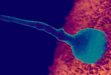 În timpul iernii, bărbații produc cele mai multe spermă