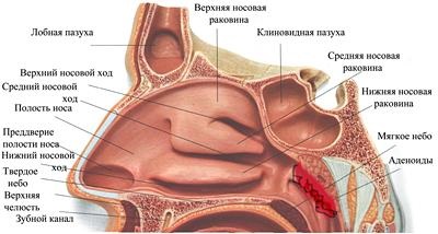 Adenoidele - cauzele adenoidelor - simptomele adenoidelor