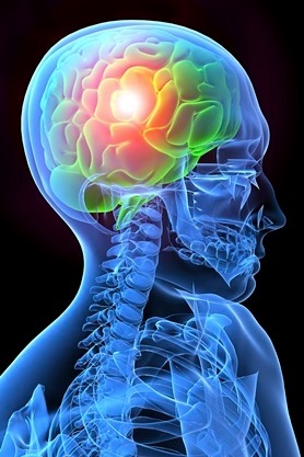 Boala alcoolică a creierului - asociație științifică și medicală - narcologie