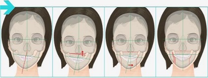 Operatie orala si maxilo-faciala - servicii si preturi de chirurgie maxilo-faciala