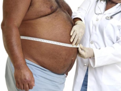 Hány kilogramm egy 3-as fokozatú elhízás számítási szabályt, kezelés