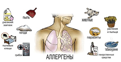 Nyomás a bronchiális asztma