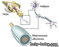 Demilinizarea - distrugerea tecii de mielină a fibrelor nervoase ca rezultat al inflamației, ischemiei,