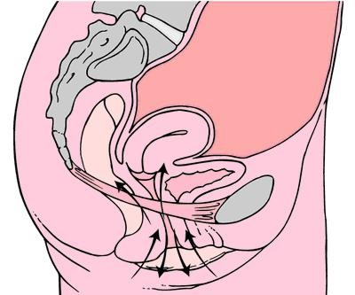 Efectuarea exercițiilor de kegel cu prolaps uterin