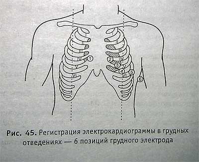 Electrocardiografia - site-ul ambulanței neoficiale al orașului Ekaterinburg