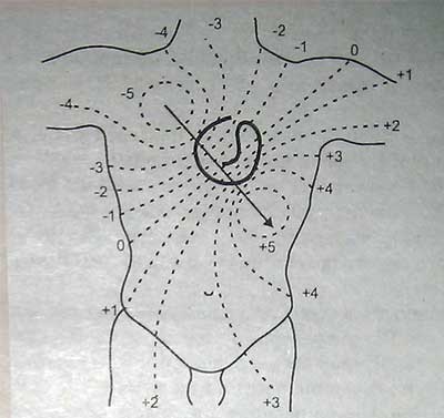 Electrocardiografia - site-ul ambulanței neoficiale al orașului Ekaterinburg