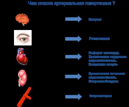 Hipertensiune arterială - ce este?