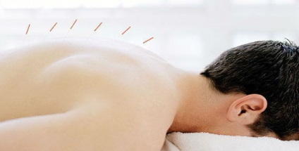Acupunctura cu tratament herniated coloanei vertebrale, prevenire, recenzii