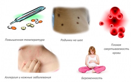 Acupunctura pentru osteocondroza cervicală