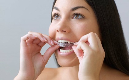 Hogyan fehéríti a fogakat otthon 5 hatékony és biztonságos módon, elmoda