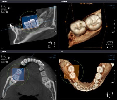 Tomografia computerizată (CT) în oportunitățile de cercetare în stomatologie