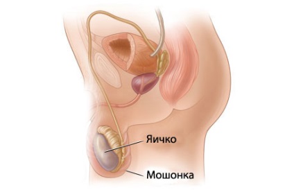 Tratamentul criptorchidismului - portal medical eurolab