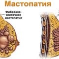 Cauza și tratamentul lunar neregulat