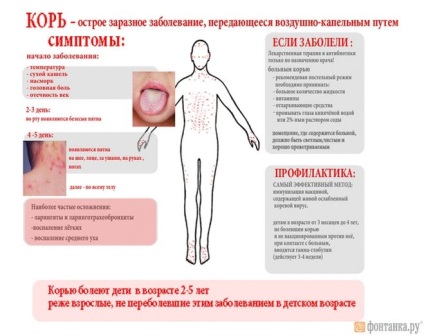 Adulții au nevoie de o inoculare împotriva rujeolei, dacă în copilărie a fost făcută