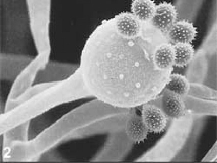 Atenție infecție fungică, știință și viață