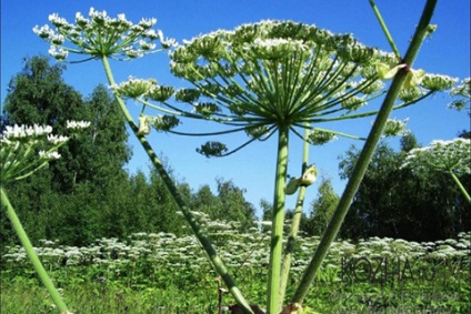 Burns a hogweed tünetek, elsősegély és kezelési