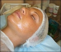 Acnee - spălând pielea contaminată, cum să scapi de acnee - despre acnee