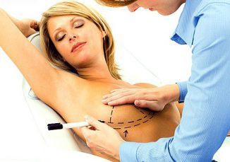 Reabilitarea după mammoplastie în zile, perioada de reabilitare