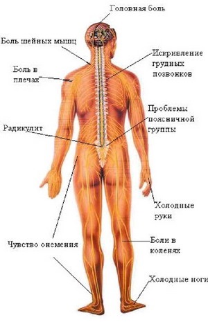 Reflexoterapia cu osteocondroza coloanei vertebrale