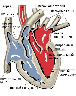 Stenoza stenozei aortice (stenoza valvulară aortică, stenoza aortică subvalvulară)