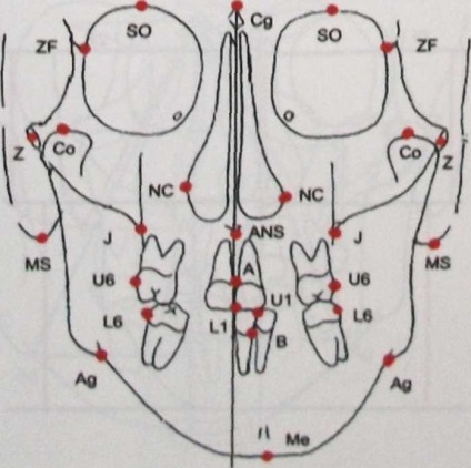 Teleradiografia capului în proiecție directă - stadopedia