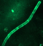 Tema 6 Diagnosticul microbiologic al infecțiilor zoonotice