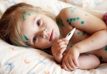Varicela la copii - simptome, cauze, tratament și igienă