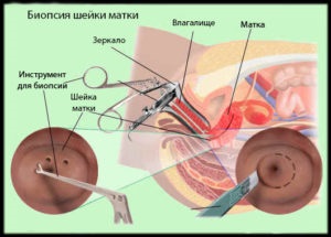 Eroziunea cervicală patologică și normală