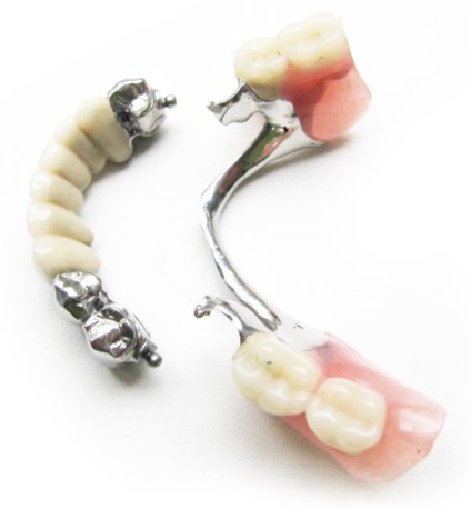 Proteze dentare din plastic, indicații pentru instalare, îngrijire