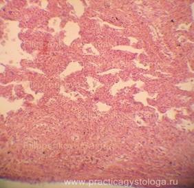 Alveolita fibroza este o practica a unui histolog