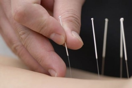 Acupunctura (fumatul) de la fumat comentarii despre tratamentul pacientului