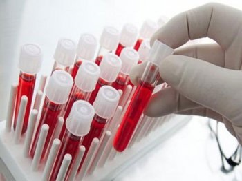 Cum celulele roșii din sânge transportă oxigen - știm cum!